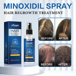 LUNOON Minoxidil Hair Growth Spray - HaiyiBeauty
