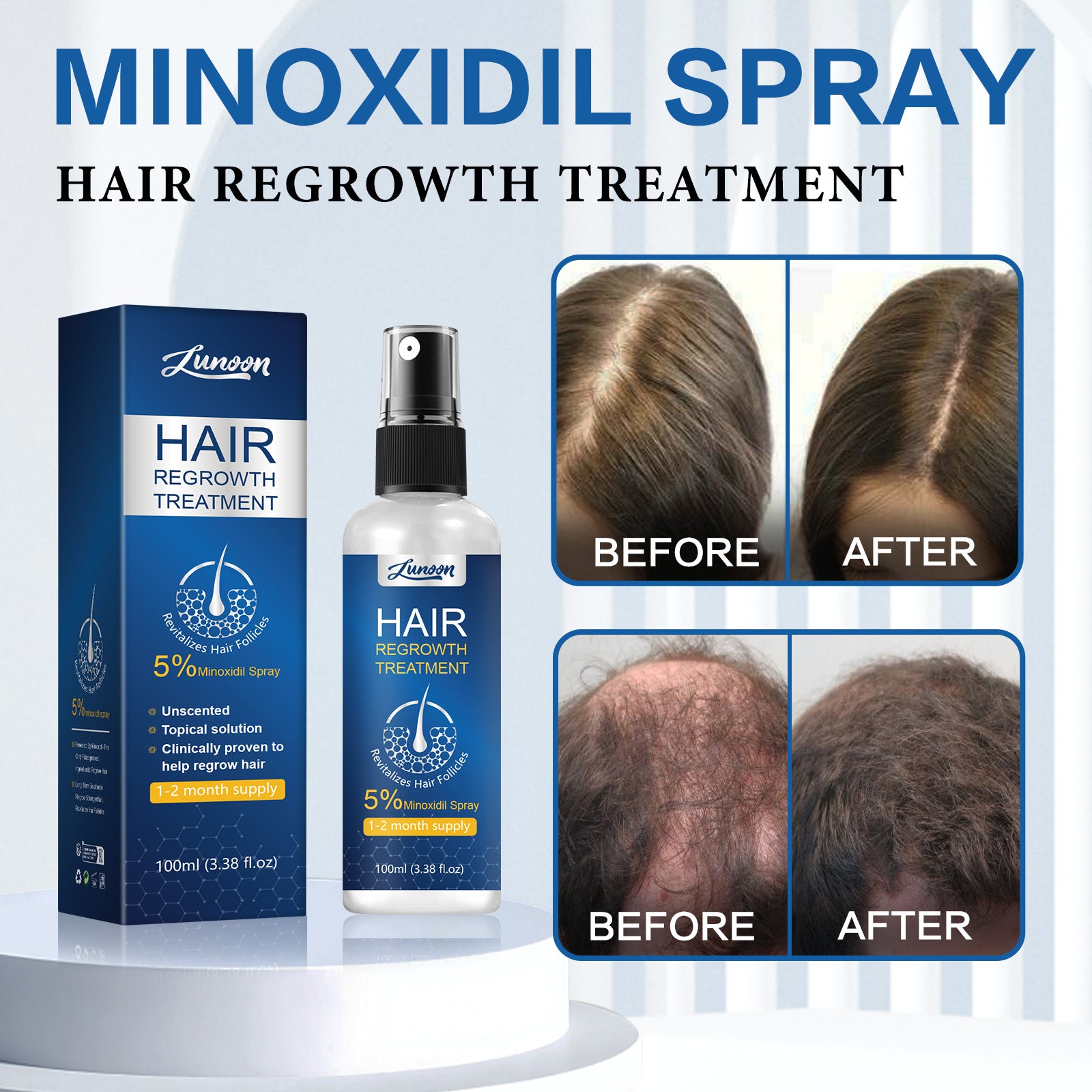 LUNOON Minoxidil Hair Growth Spray - HaiyiBeauty