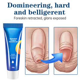 Foreskin Correction Gel - HaiyiBeauty