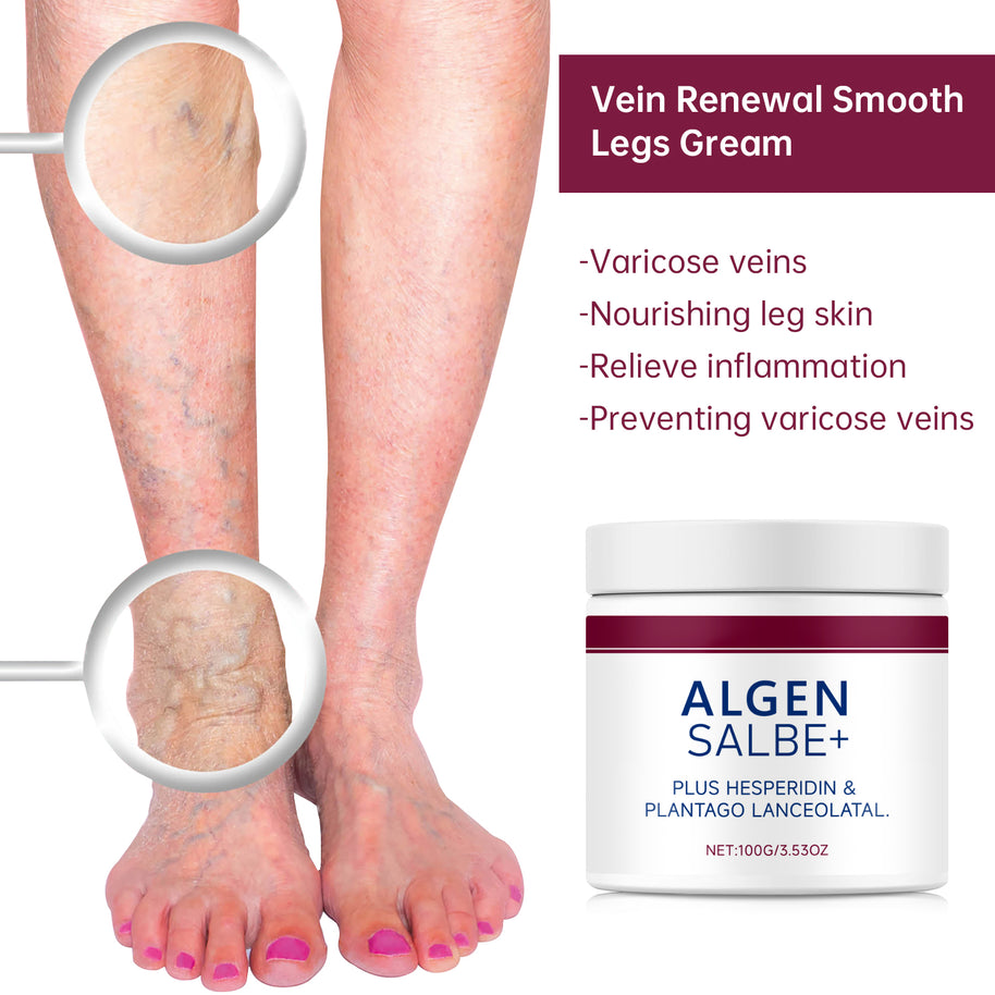 Varicose Vein Relief Cream - HaiyiBeauty