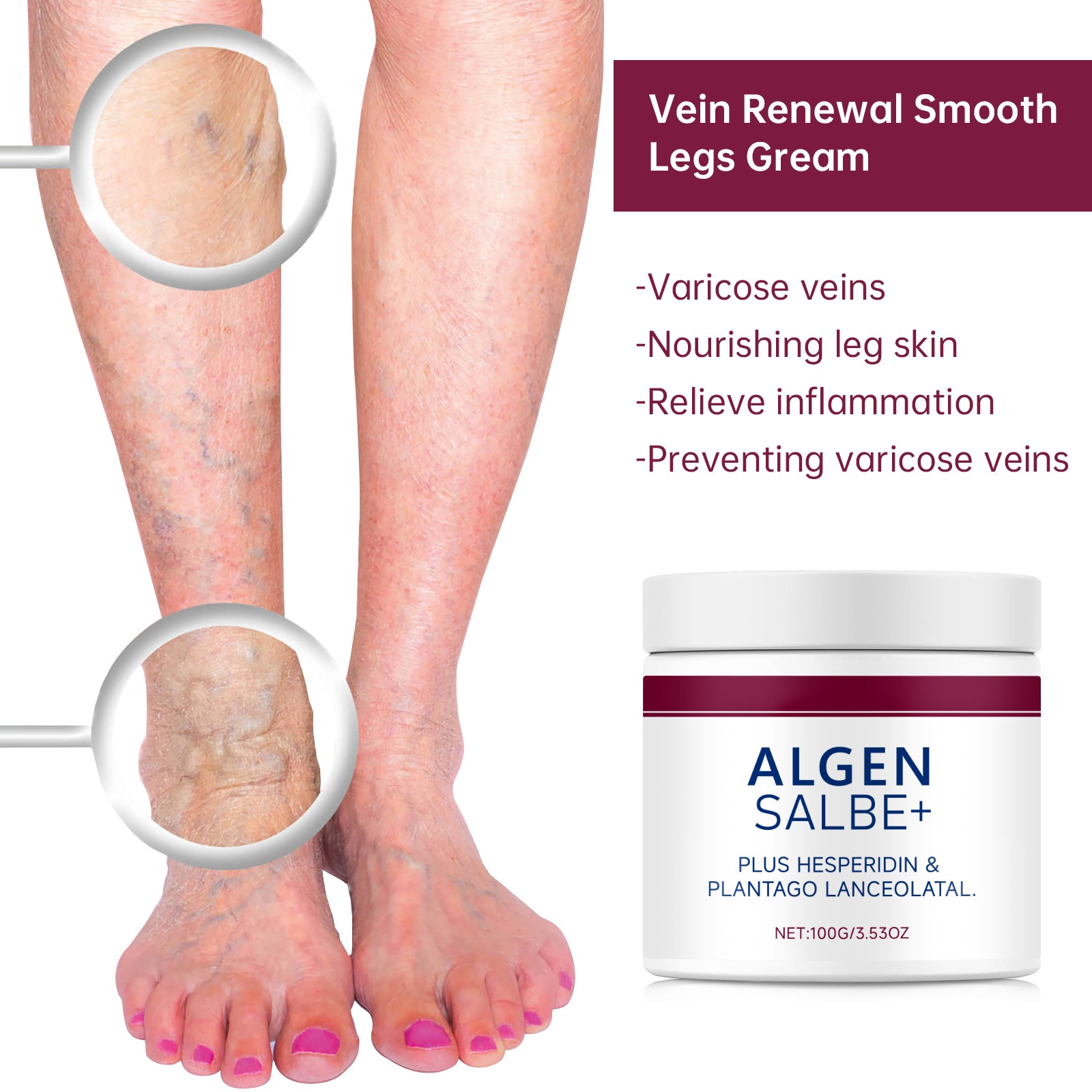 Varicose Vein Relief Cream - HaiyiBeauty