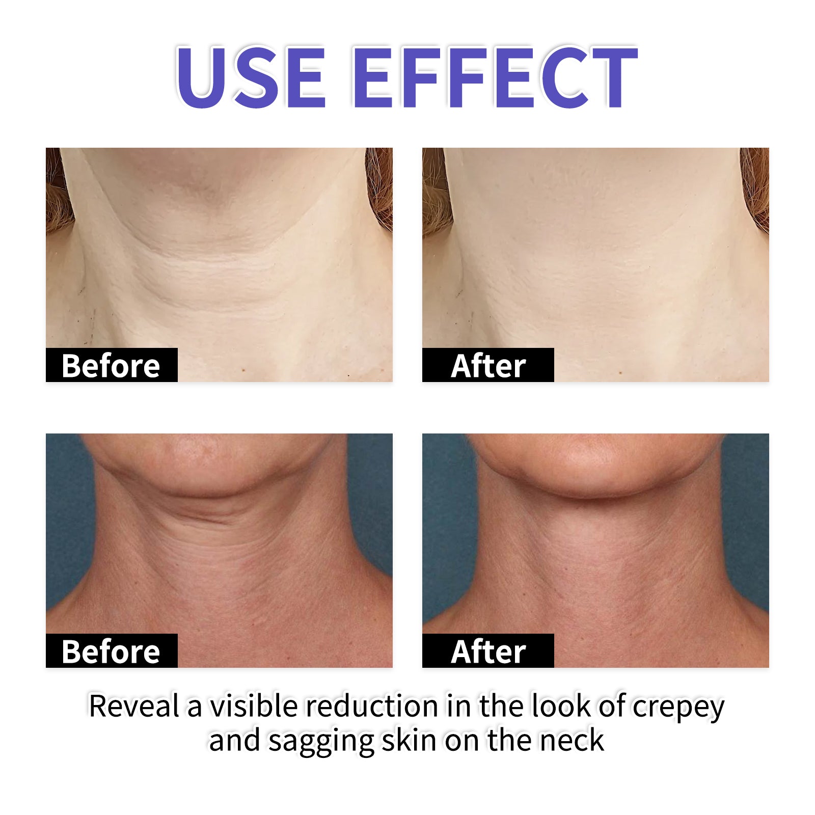 LUNOON Firming and Lifting Neck Cream - HaiyiBeauty