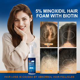 5% Minoxidil Biotin Foaming Agent - HaiyiBeauty
