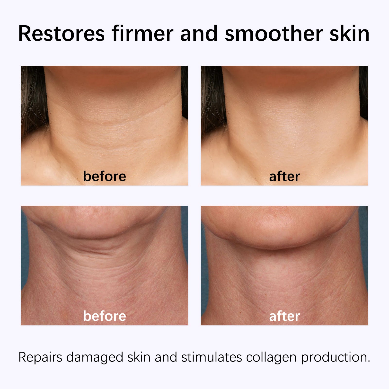 GROEI Snake Oil Neck Mask - HaiyiBeauty
