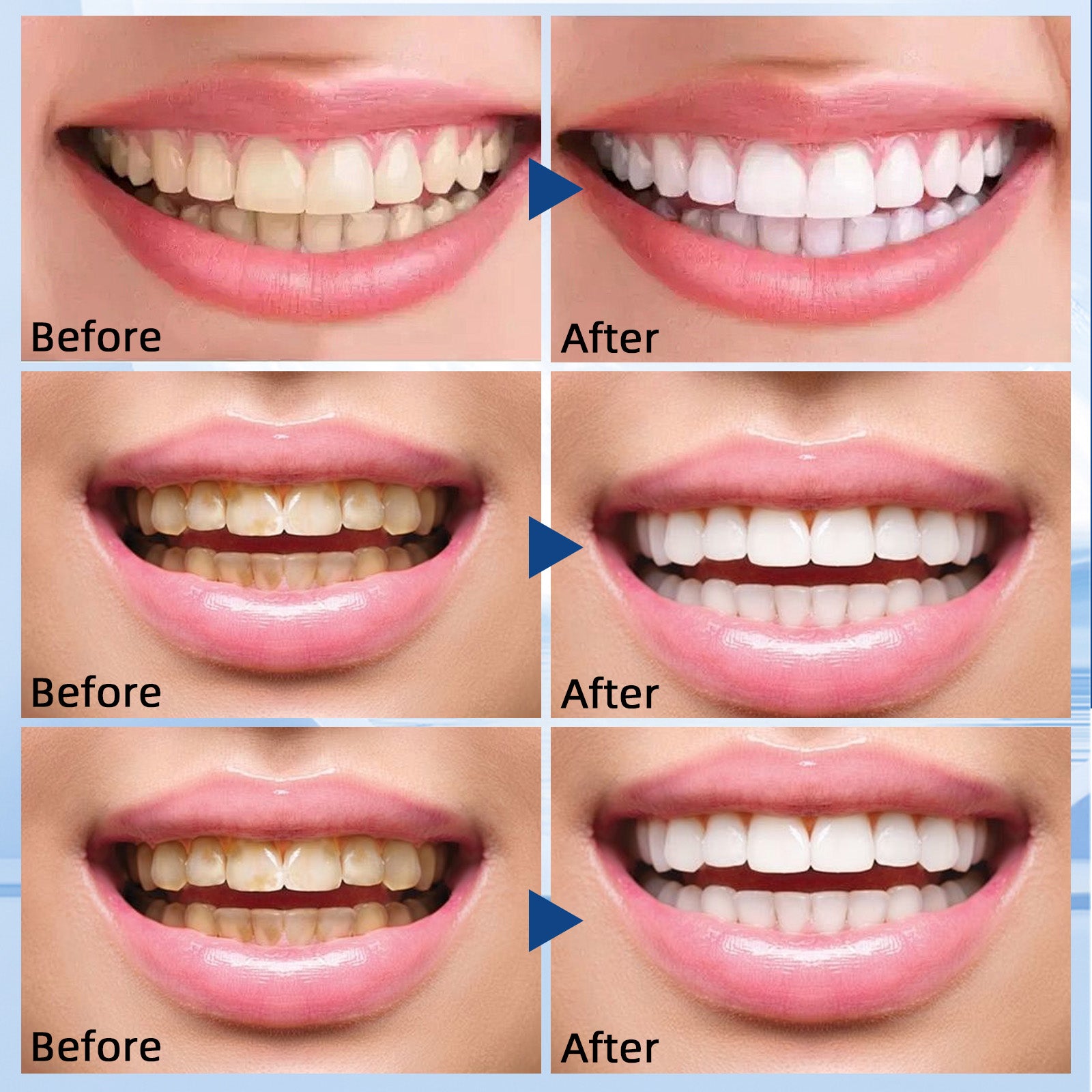 GROEI Hydroxyapatite Tooth Powder - HaiyiBeauty