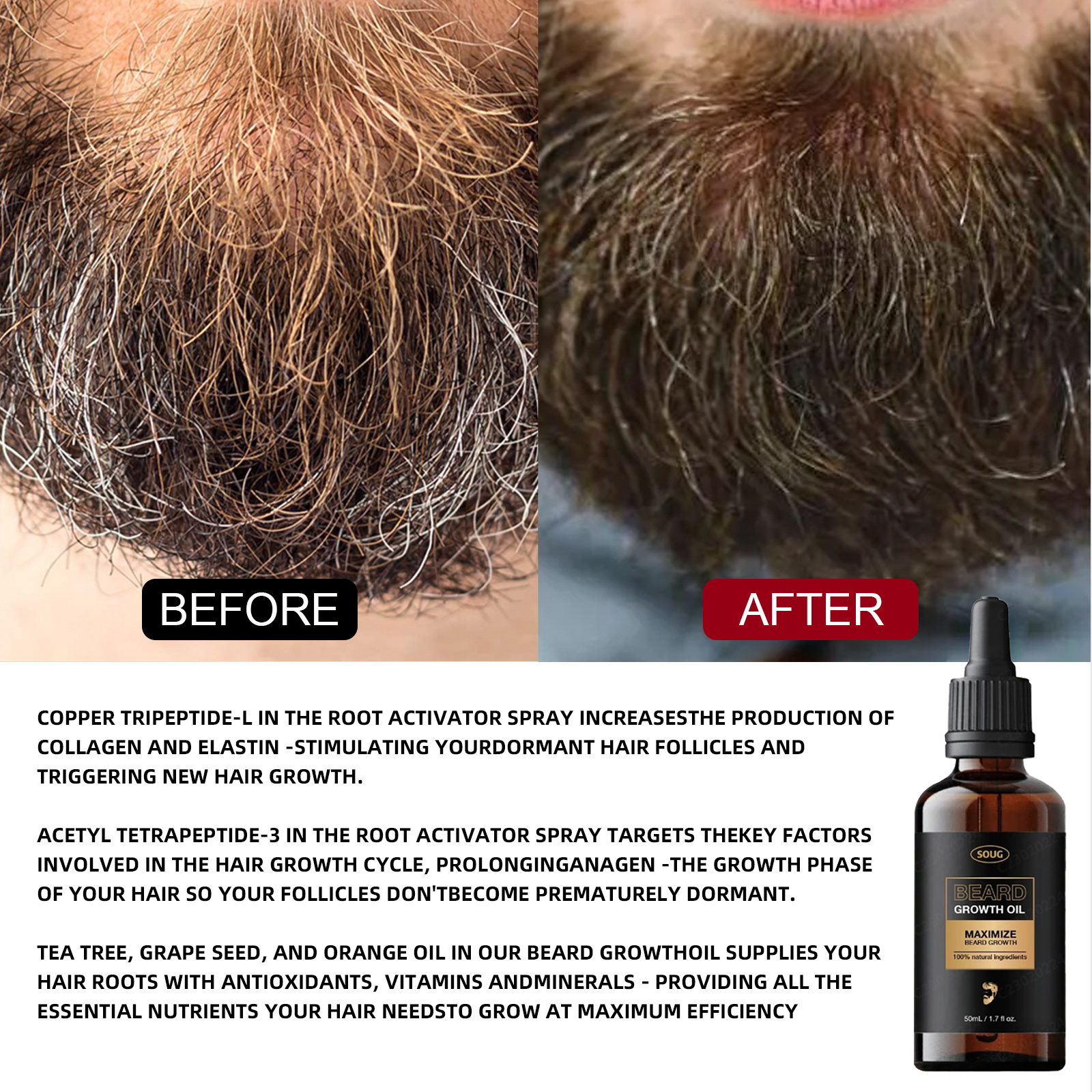 SOUG Beard Growth Oil - HaiyiBeauty