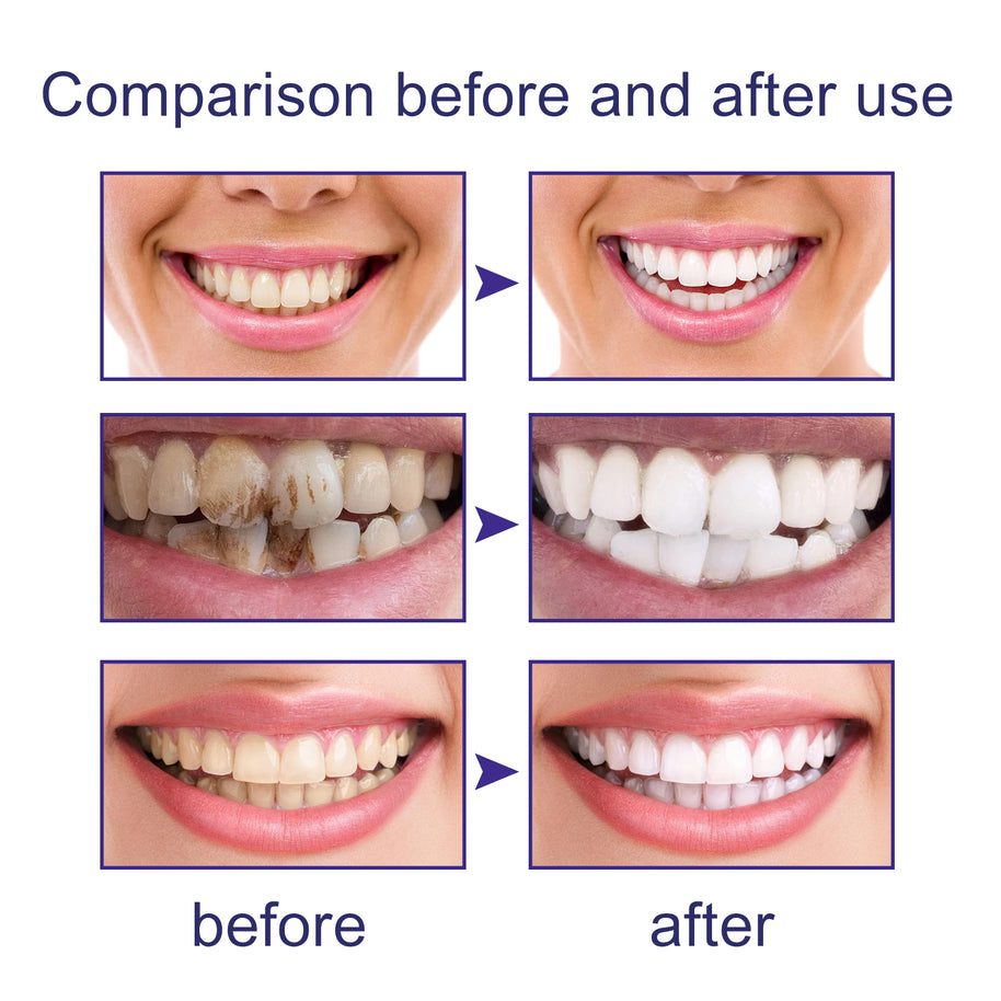 V34 Cleansing Mousse Toothpaste - HaiyiBeauty
