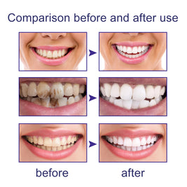 V34 Cleansing Mousse Toothpaste - HaiyiBeauty
